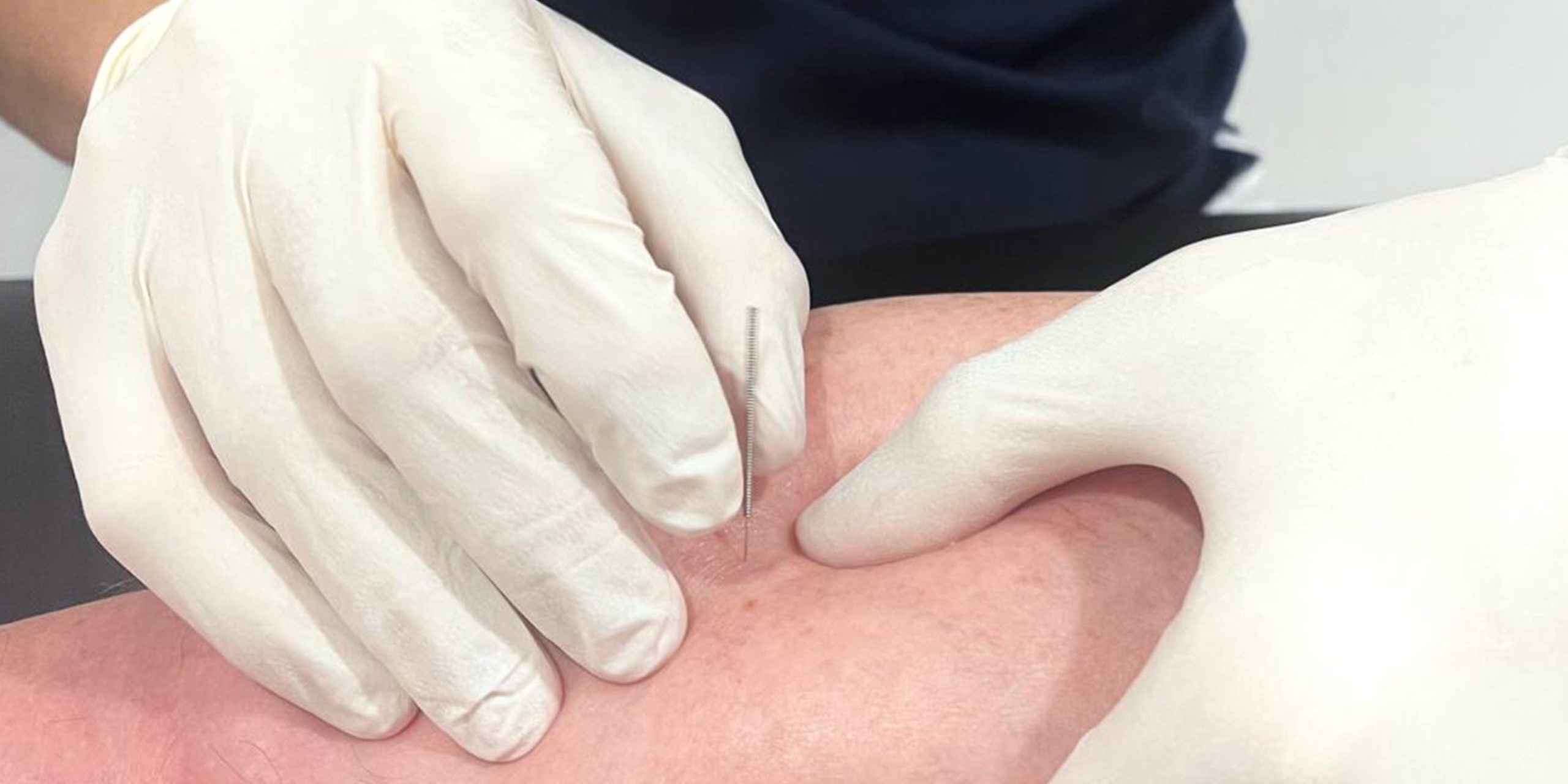 BENSALUD_puncion_seca_BENETUSSER