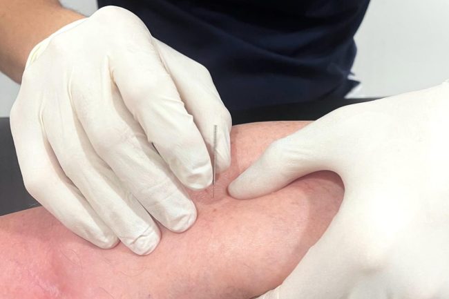 BENSALUD_puncion_seca_BENETUSSER